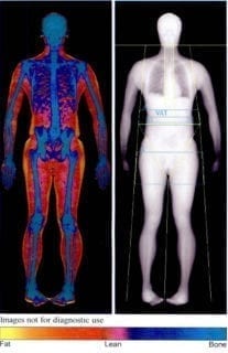 Body Composition Analysis Bca Des Moines University