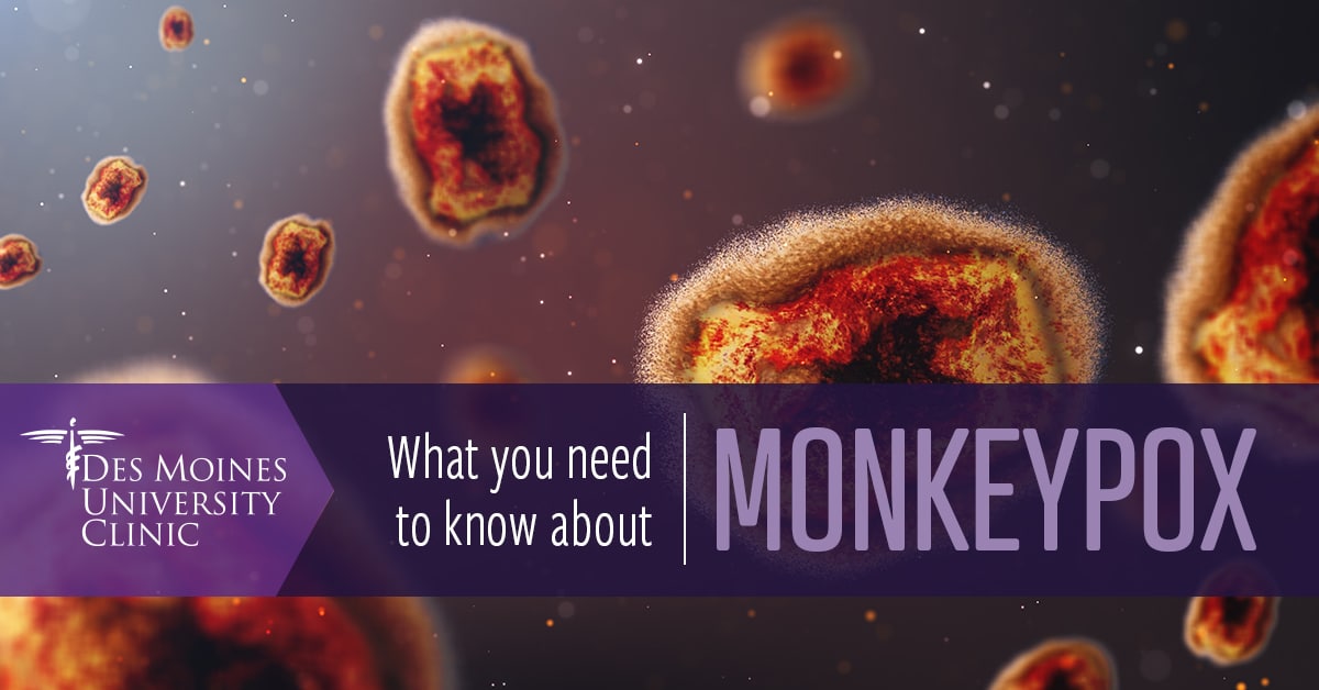 What you need to know about Monkeypox | News | DMU